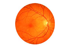 Northcliff Optometrist-diseases-of-the-eye
