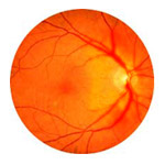 northcliff optometrist-optic-neuritis