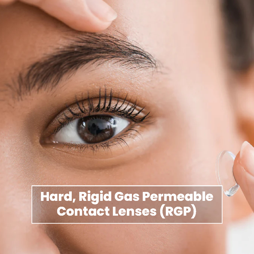 Hard. Rigid Gas Permeable Contact Lenses (RGP)